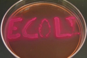 Escherichia Coli