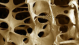 osteoporosi